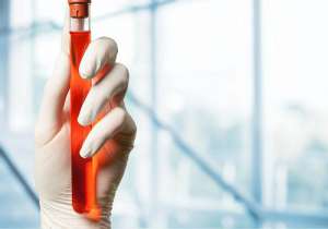 泰國試管醫(yī)院有什么好的