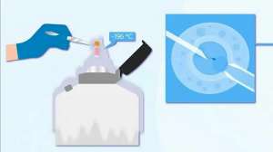 做一次試管嬰兒錢需要多少