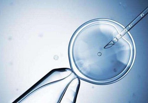 做美國試管嬰兒大概需要多少錢