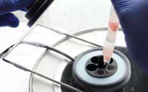 俄羅斯試管嬰兒費(fèi)用受那些影響呢