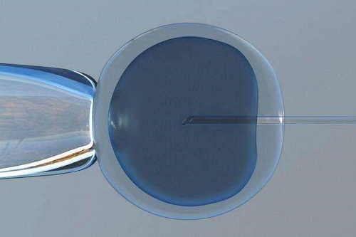 赴美試管嬰兒費(fèi)用預(yù)算