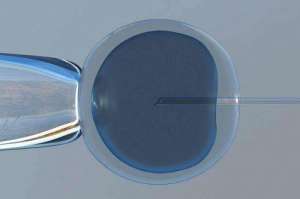 赴美試管嬰兒費用預算