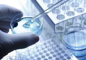 試管嬰兒費(fèi)用大概多少錢(qián)