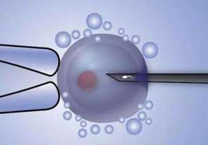 在美國(guó)做試管嬰兒需要多少錢?