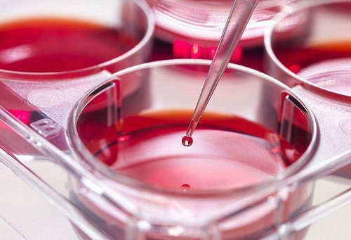 俄羅斯試管嬰兒的流程要多久