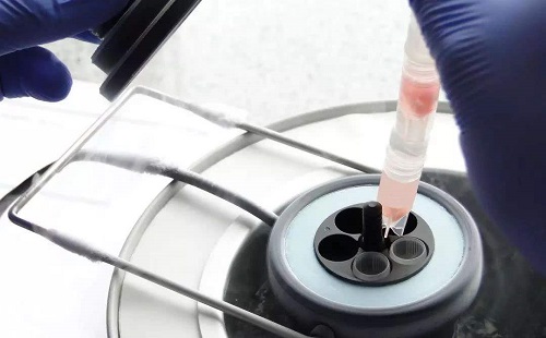 為什么選擇俄羅斯試管嬰兒