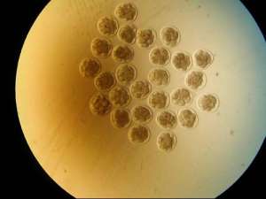 為什么做泰國試管嬰兒還需要檢查費(fèi)用